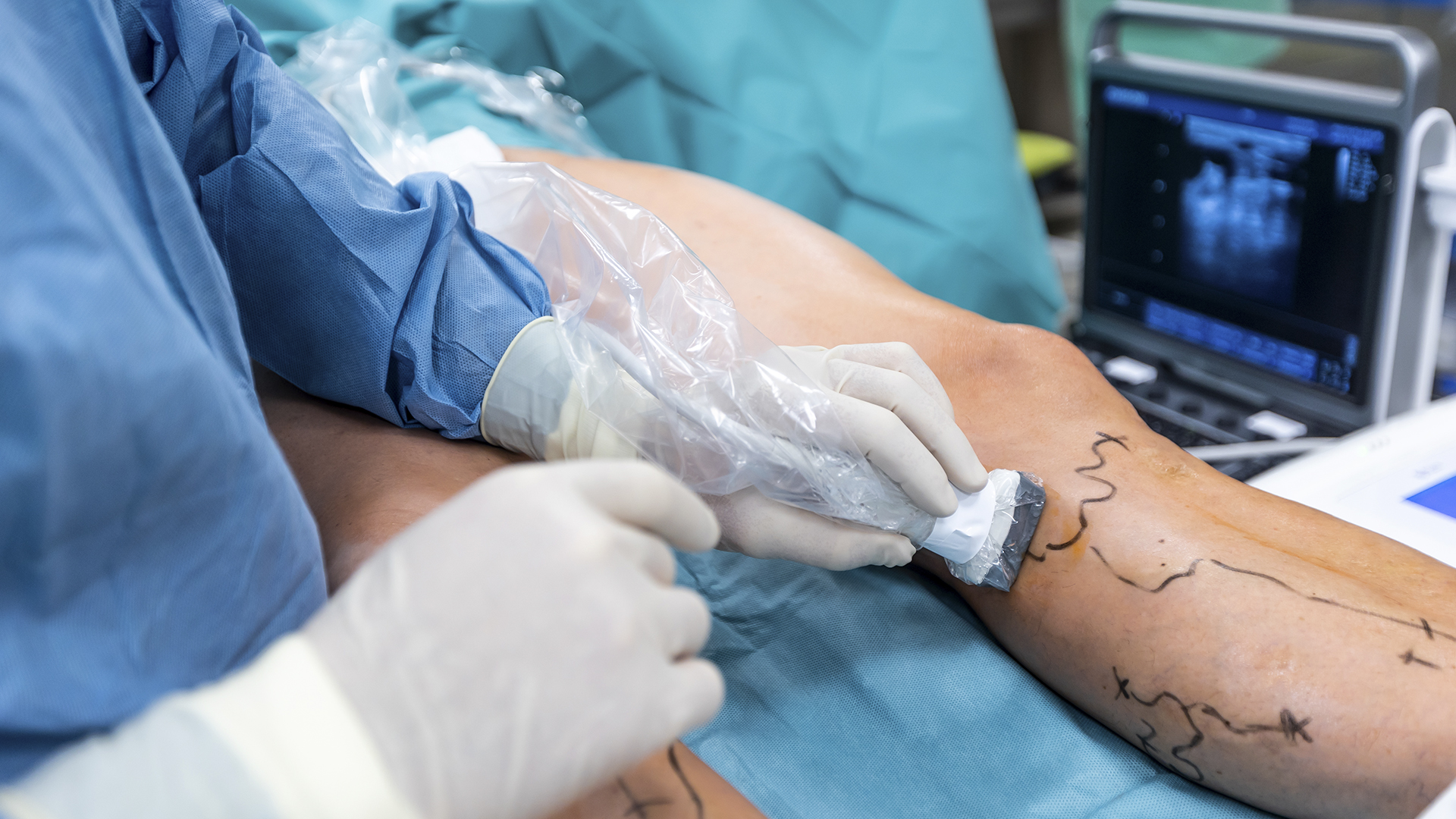 nosotros_angiologia_cirugia_vascular_lp_2