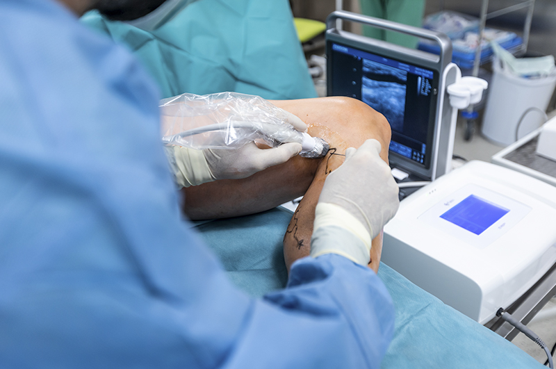 servicios_angiologia_cirugia_vascular_lp_3