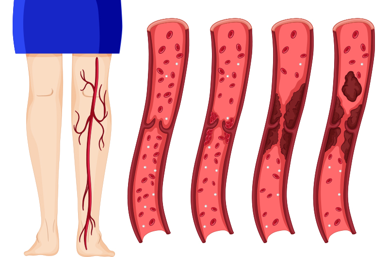 servicios_angiologia_cirugia_vascular_lp_4